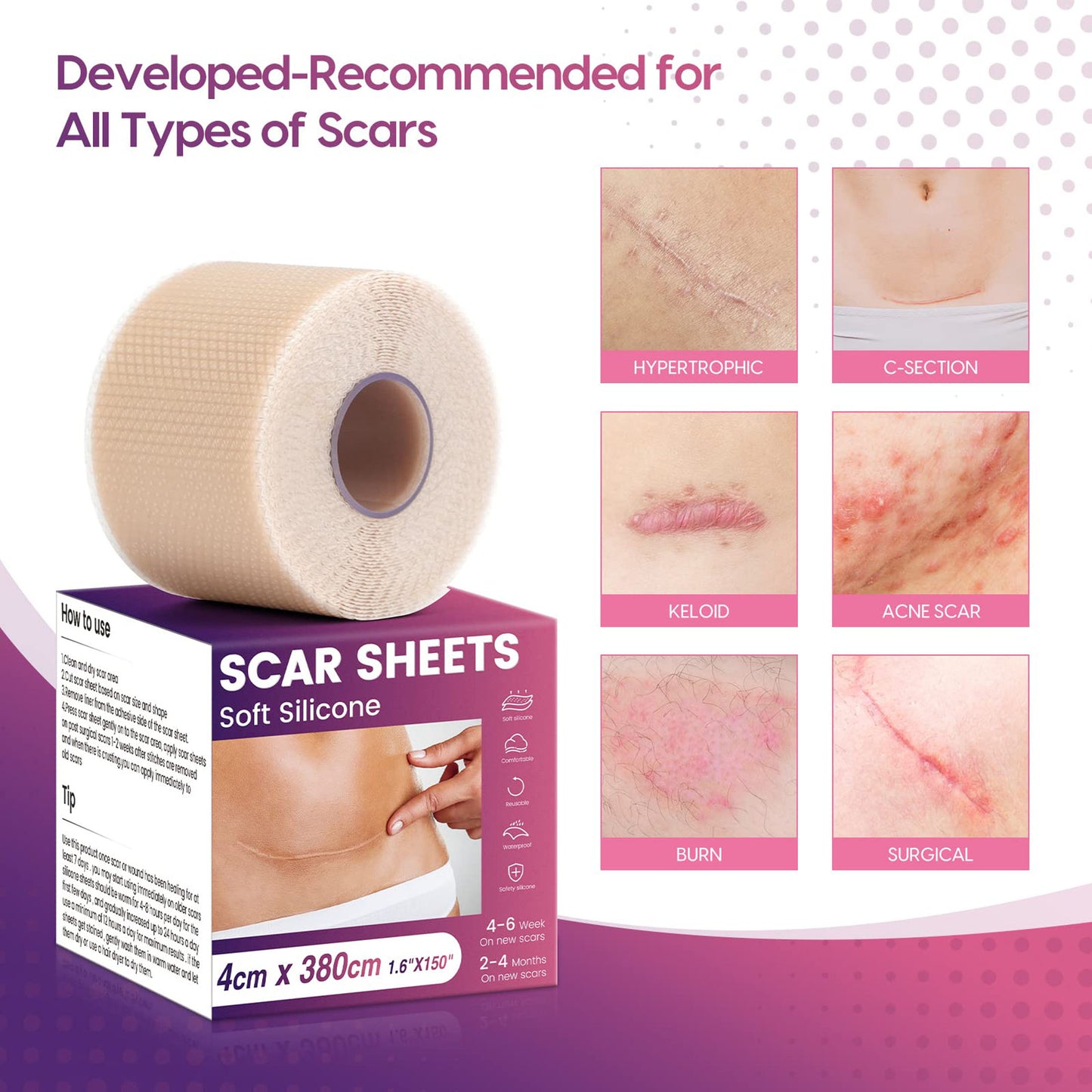 Silicone Scar Sheets (1.6” x 150” Roll-3.8M), Morfone Silicone Scar Tape