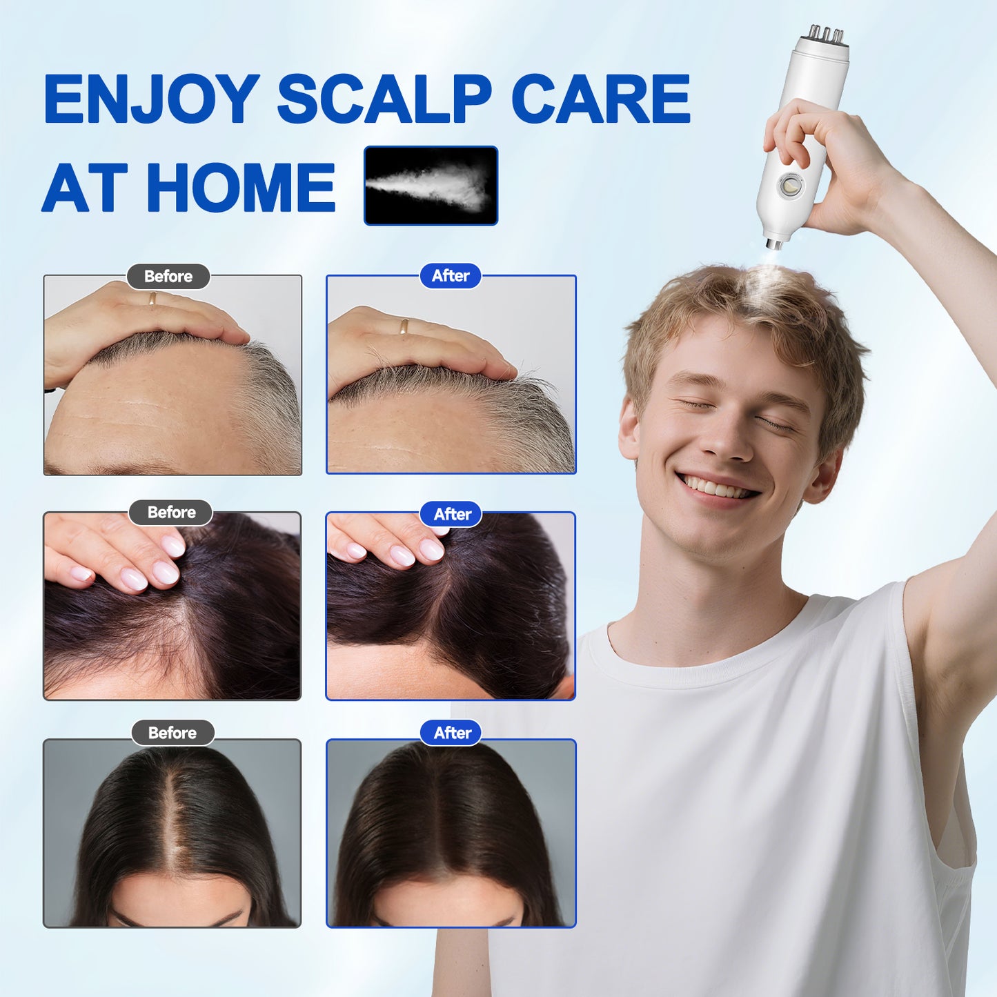 Dual-Head Electric Minoxidil Atomizer
