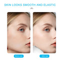 Morfone Ice Roller for Face Eyes