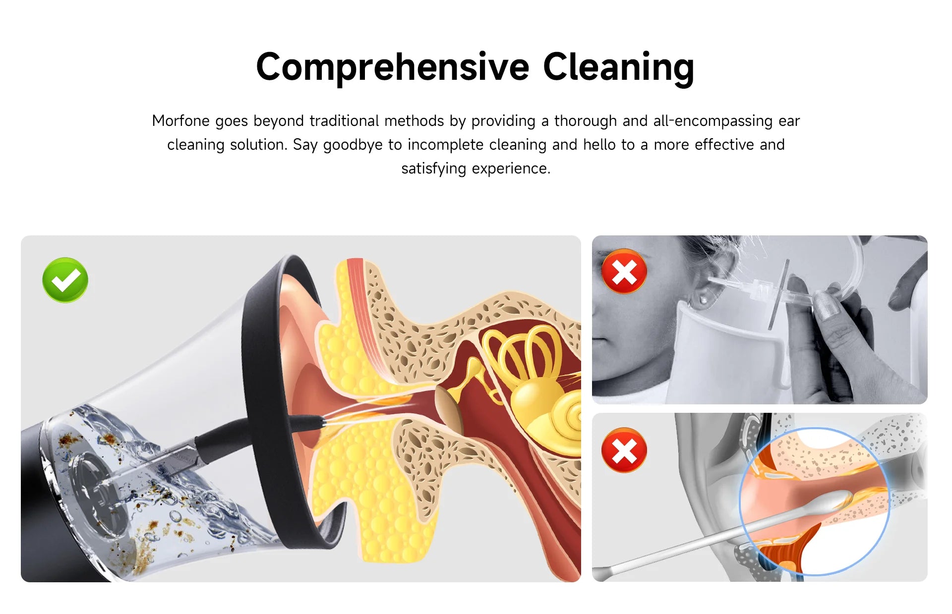 Comprehensive Cleaning with Morfone - Say goodbye to incomplete ear cleaning with our thorough solution.