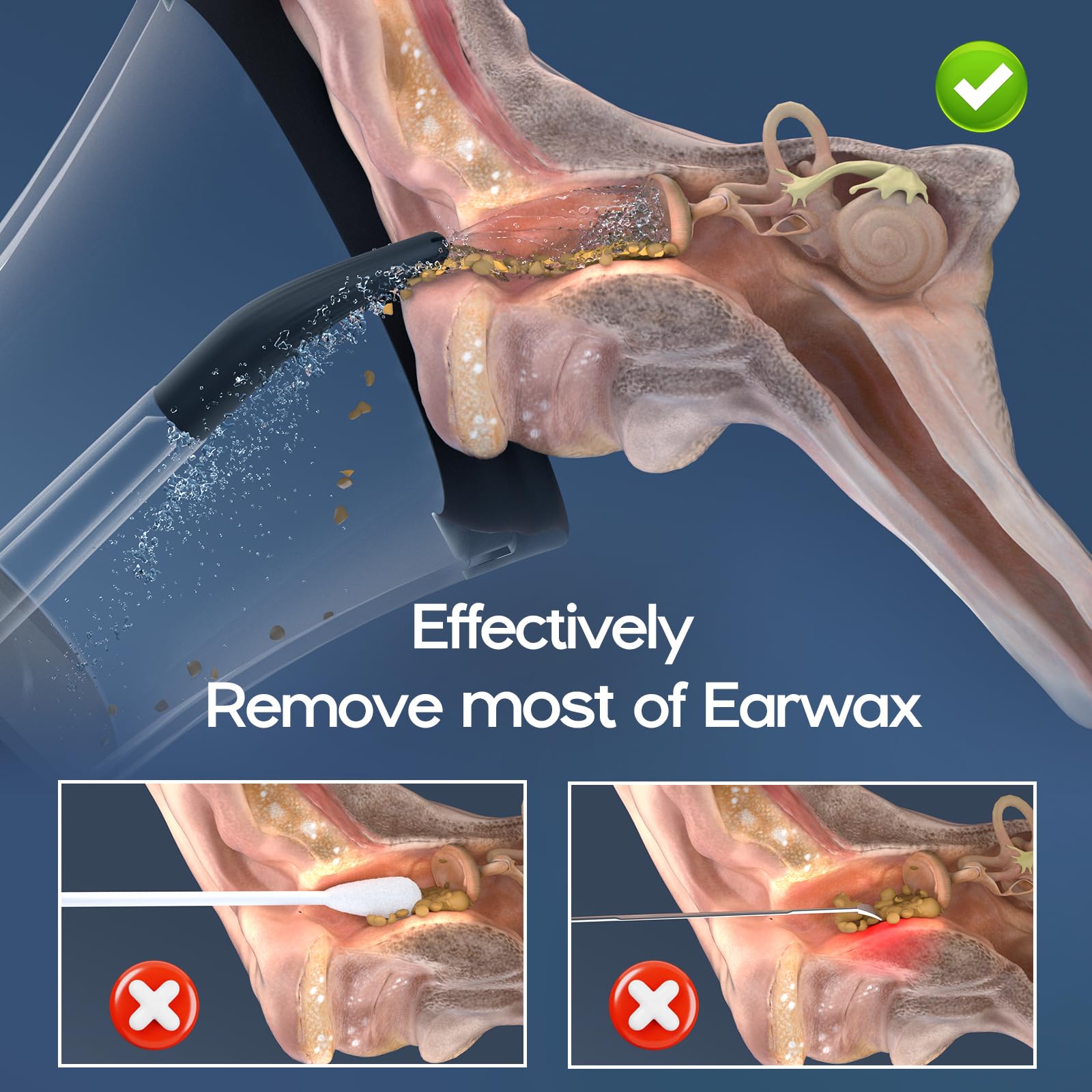 Ear Wax Removal Kit with 270° Spray for Deep Cleaning