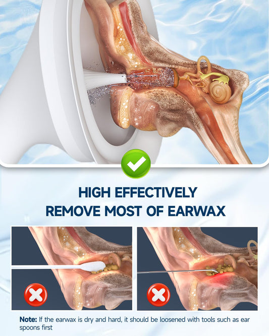 Electric Ear Wax Cleaner with 4 Pressure Modes